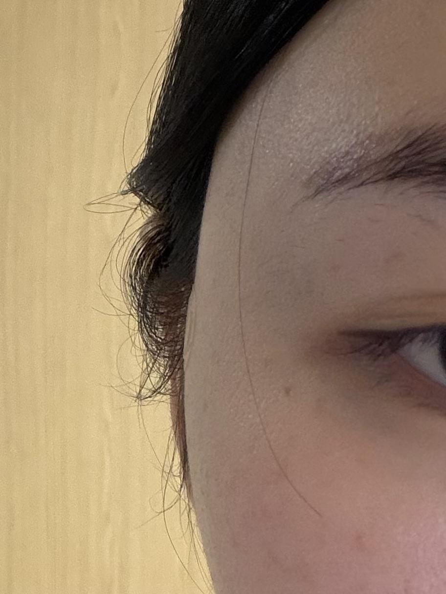 After