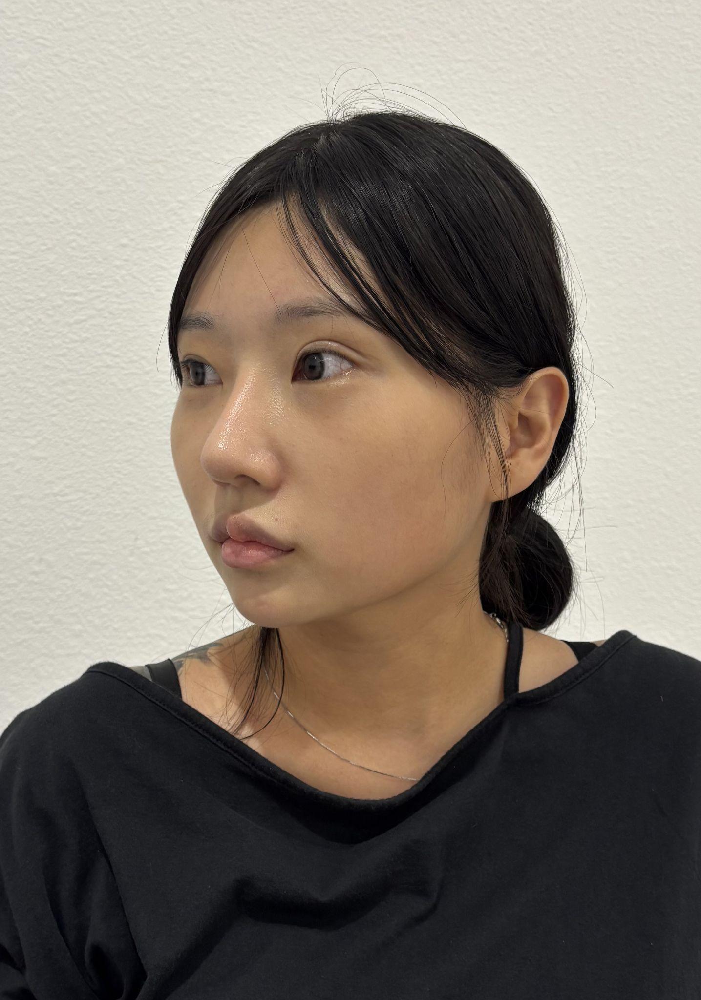 後