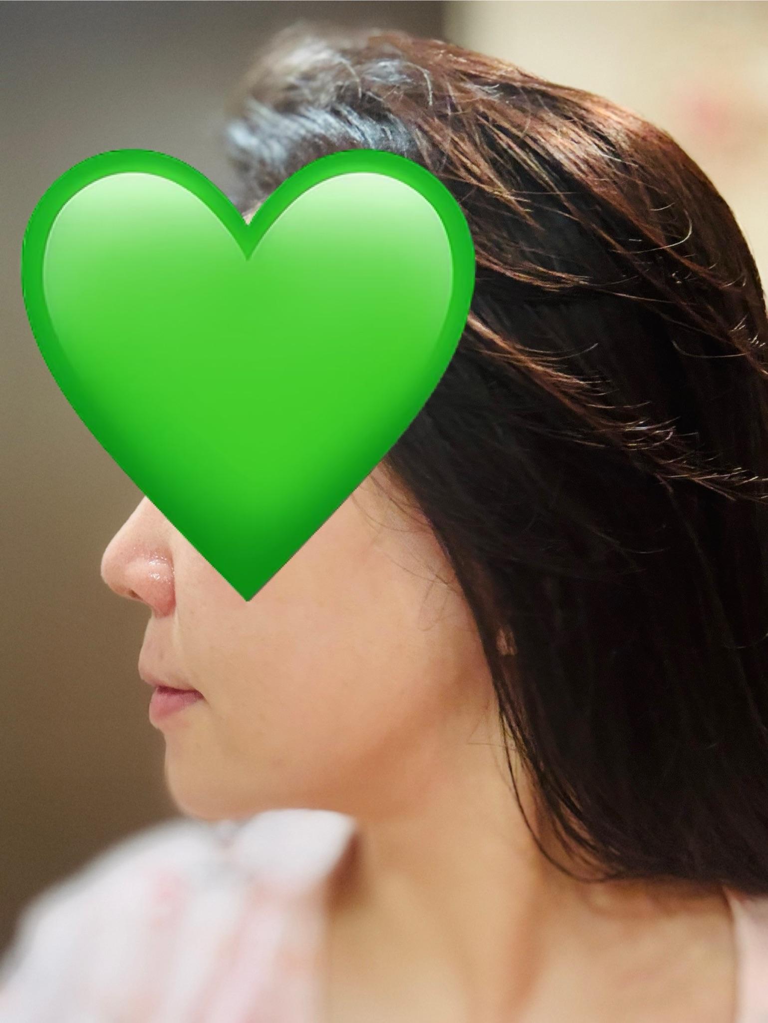 后