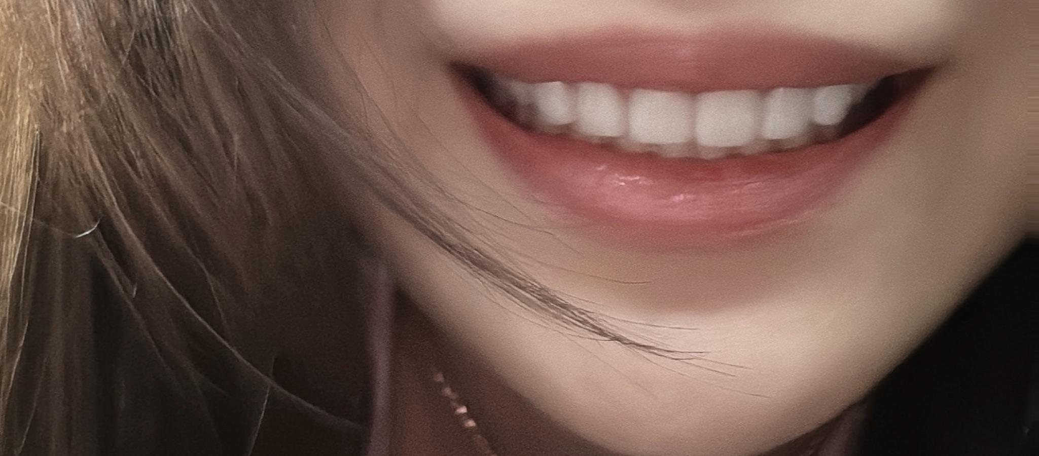 後