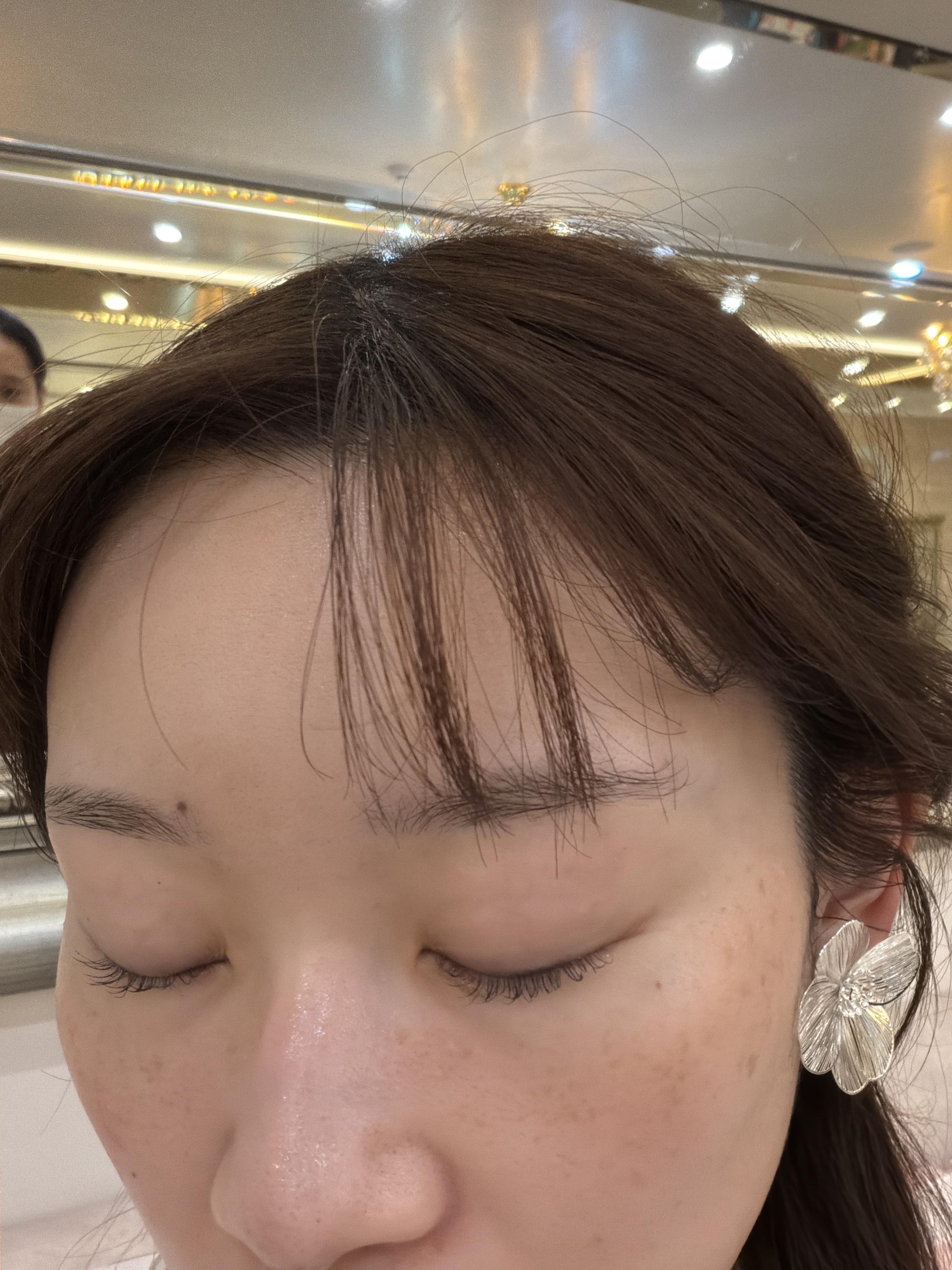 後