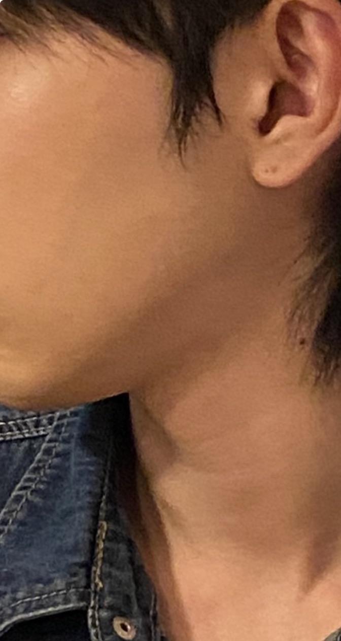 後