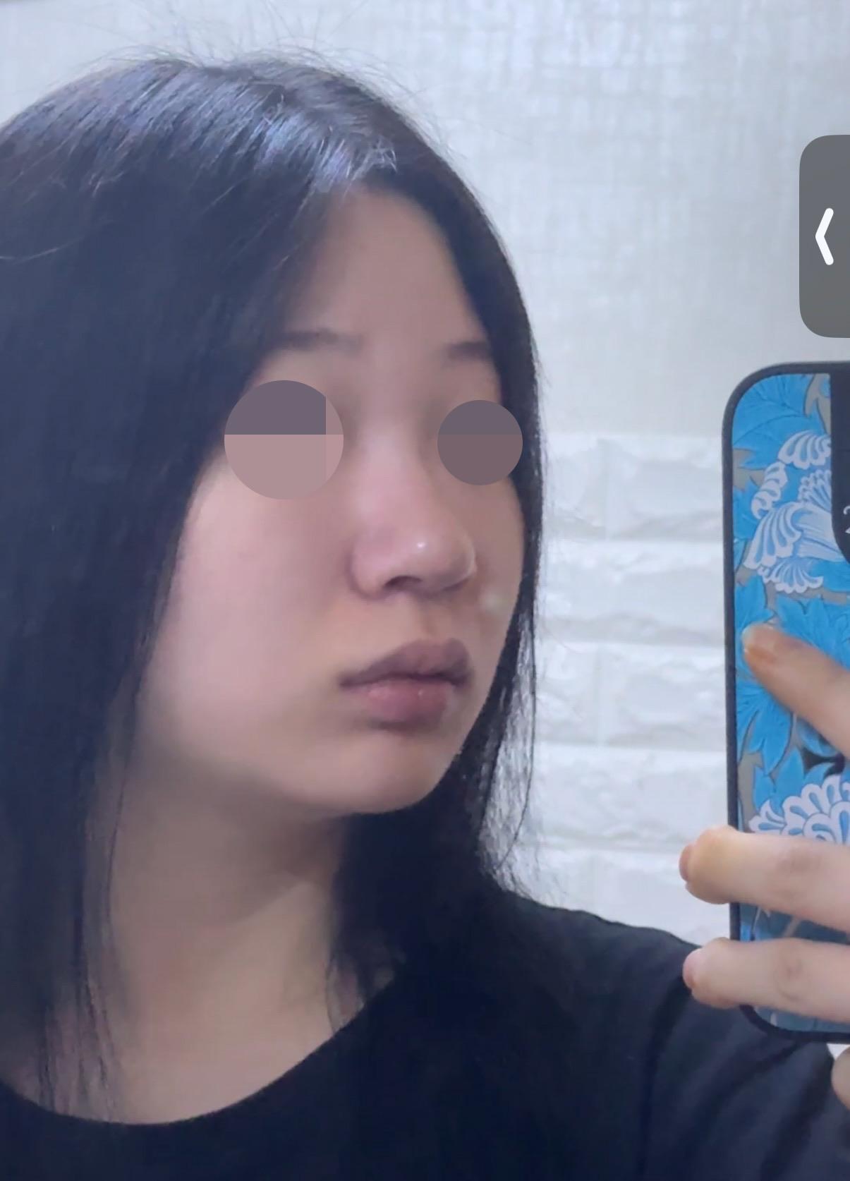 後