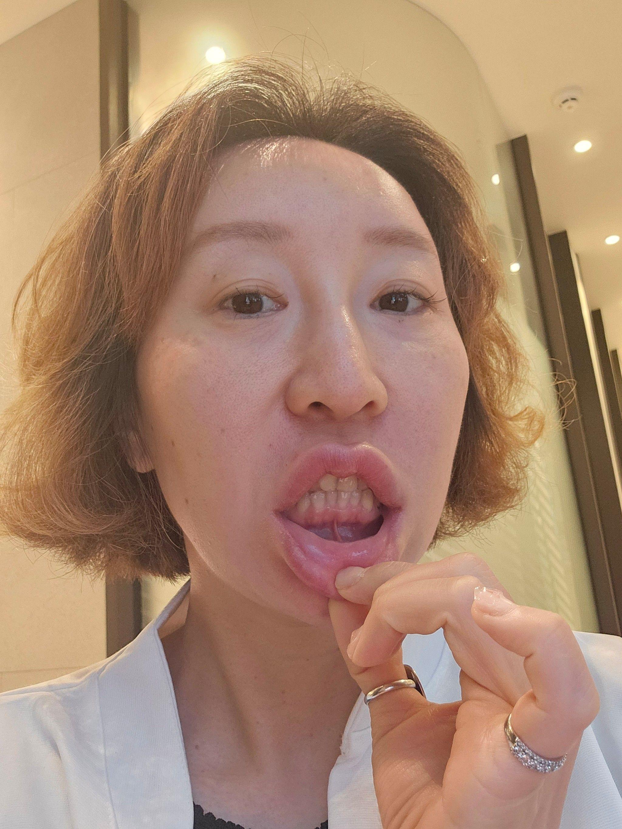 後