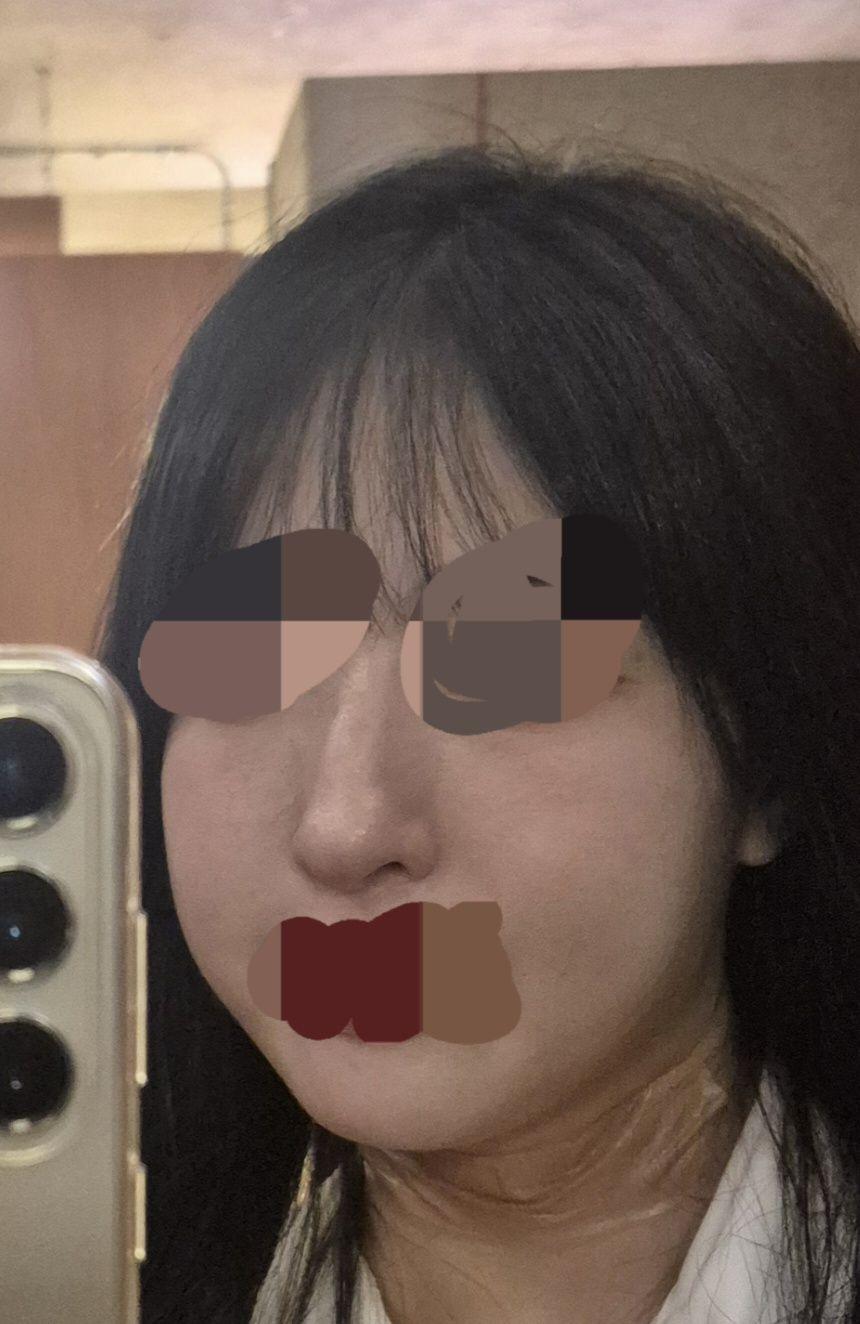 後