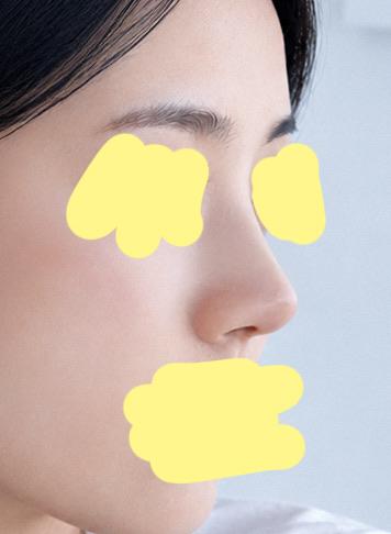 后