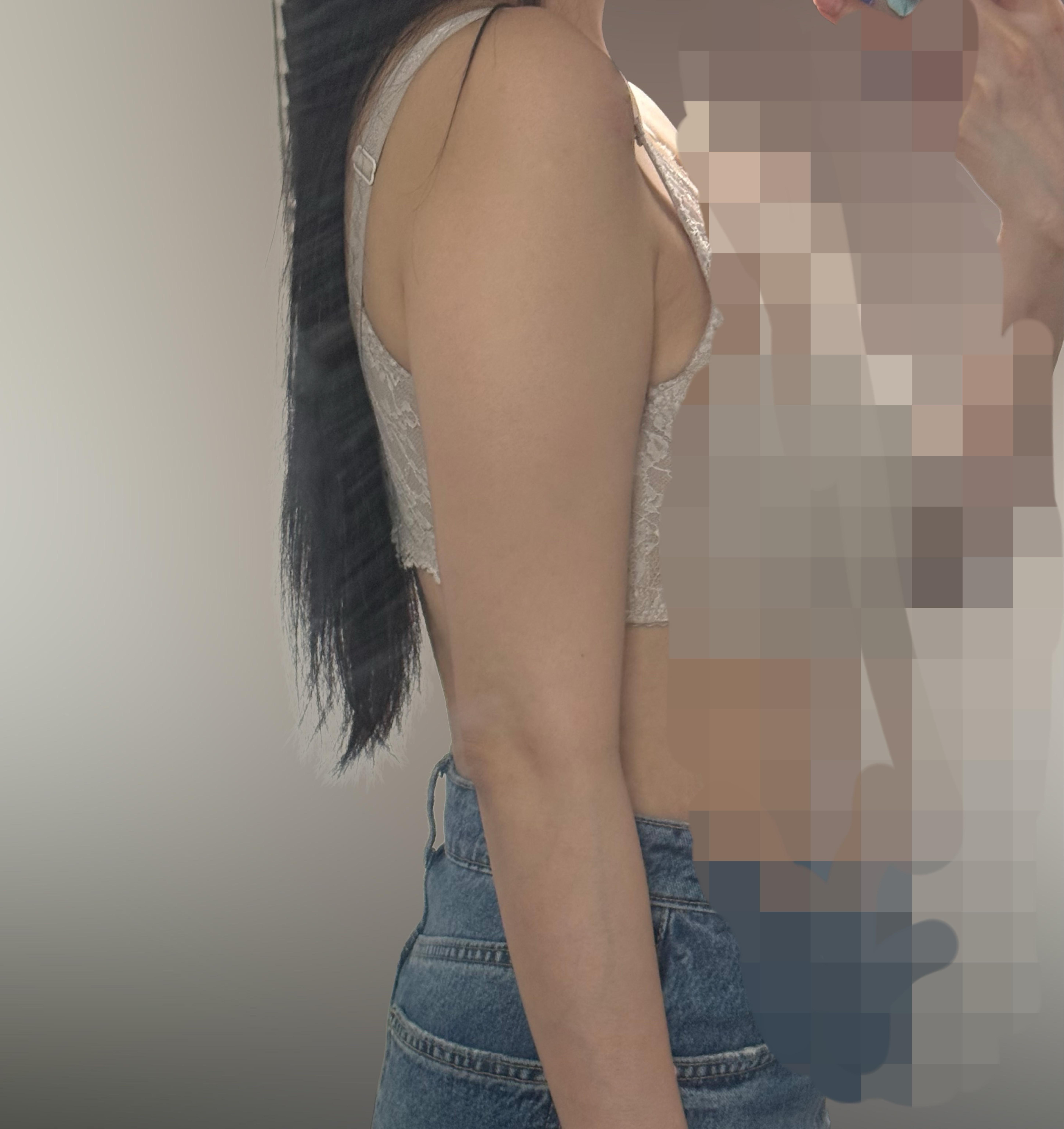 後