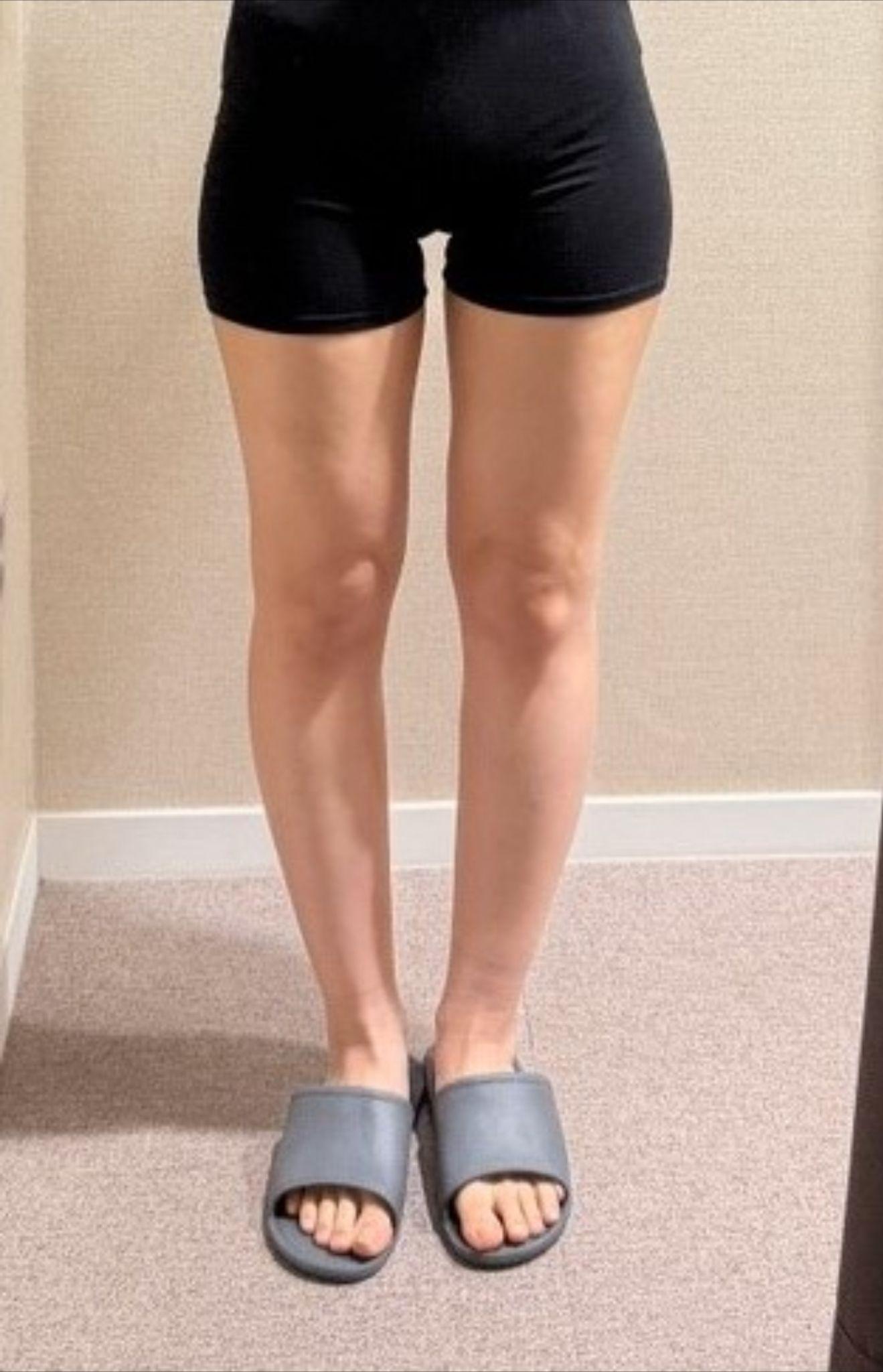後