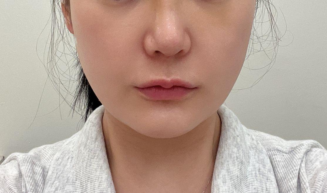 後