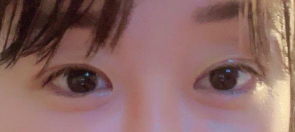 後