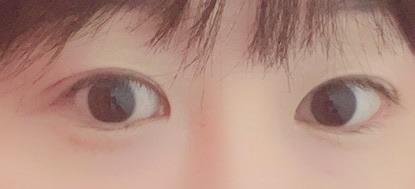 後