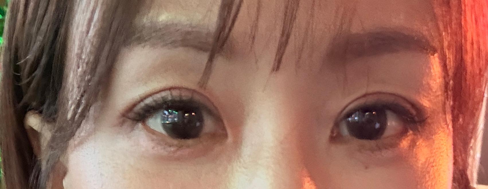 後