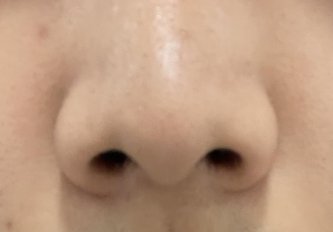 後