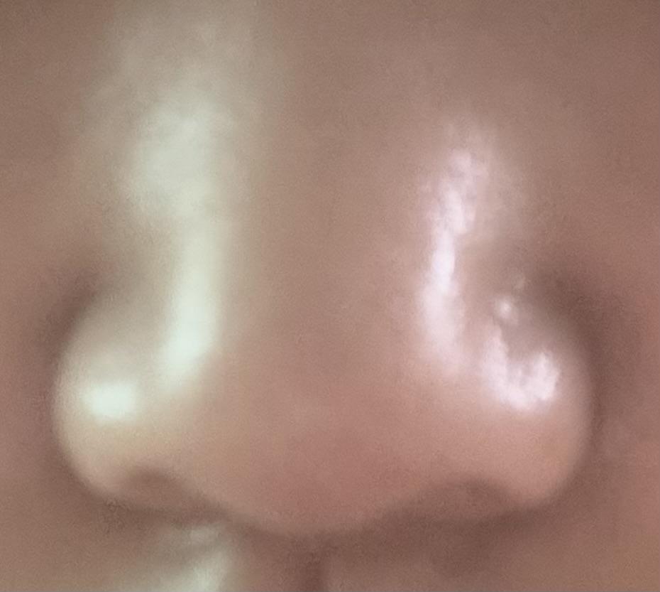 後