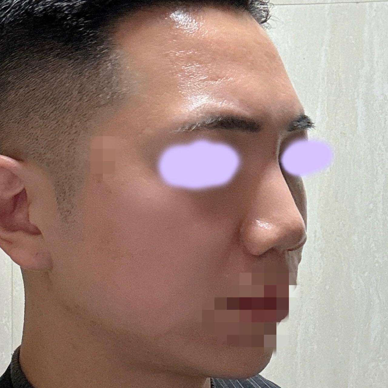 後