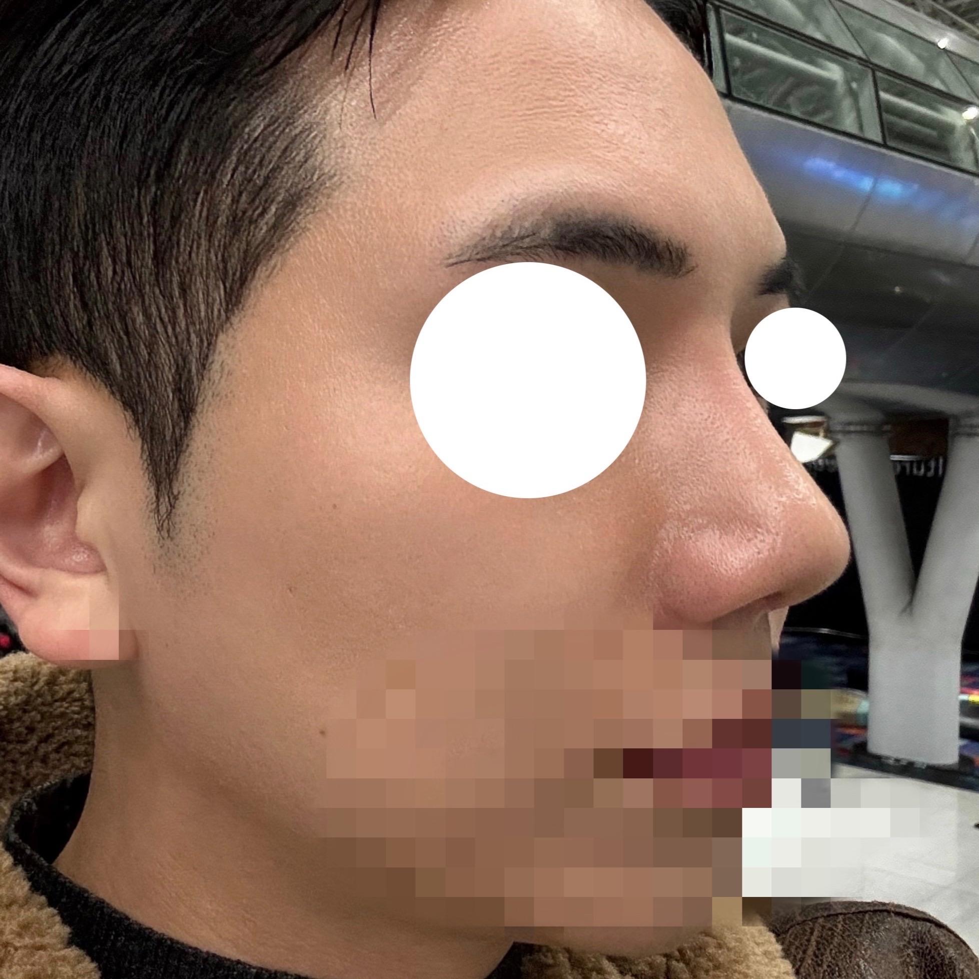 後