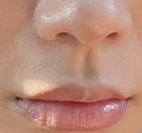 後