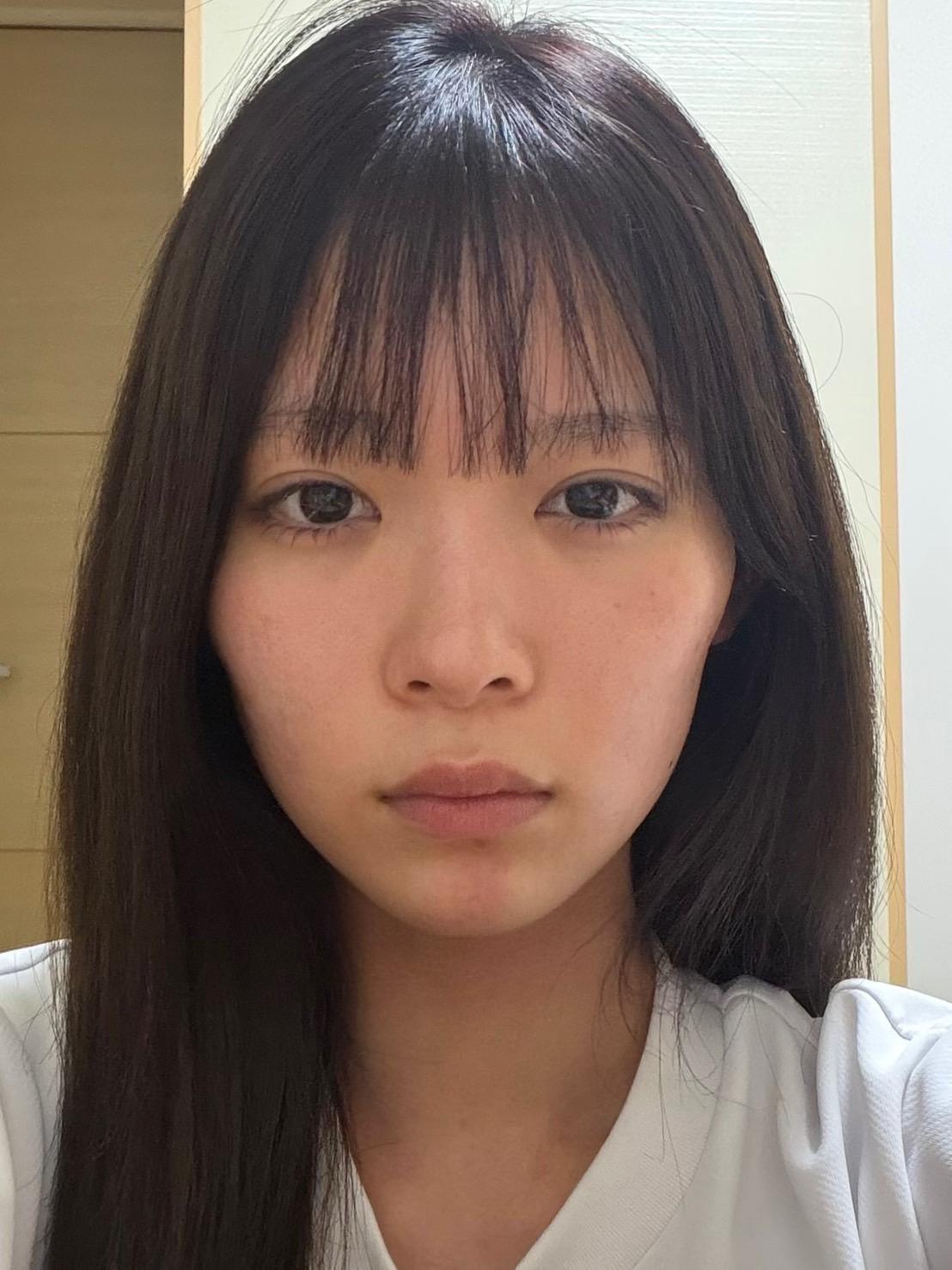 前