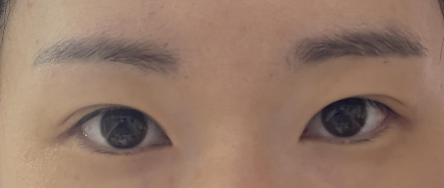後