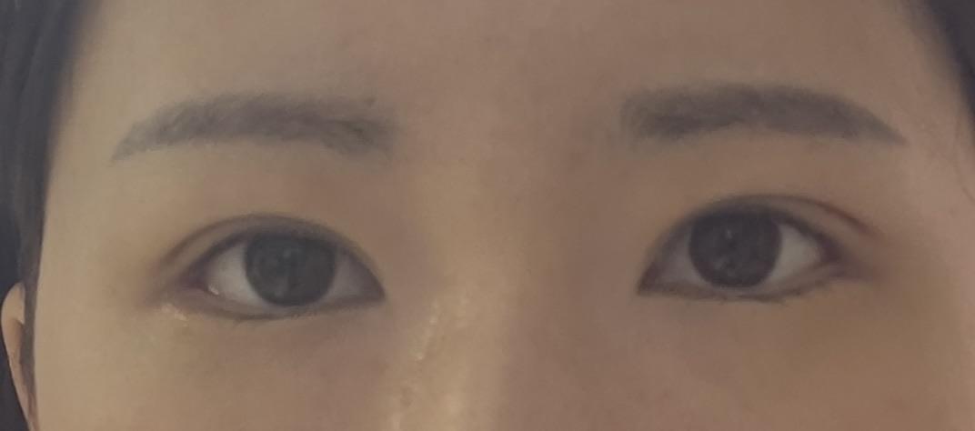 後