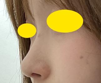 後