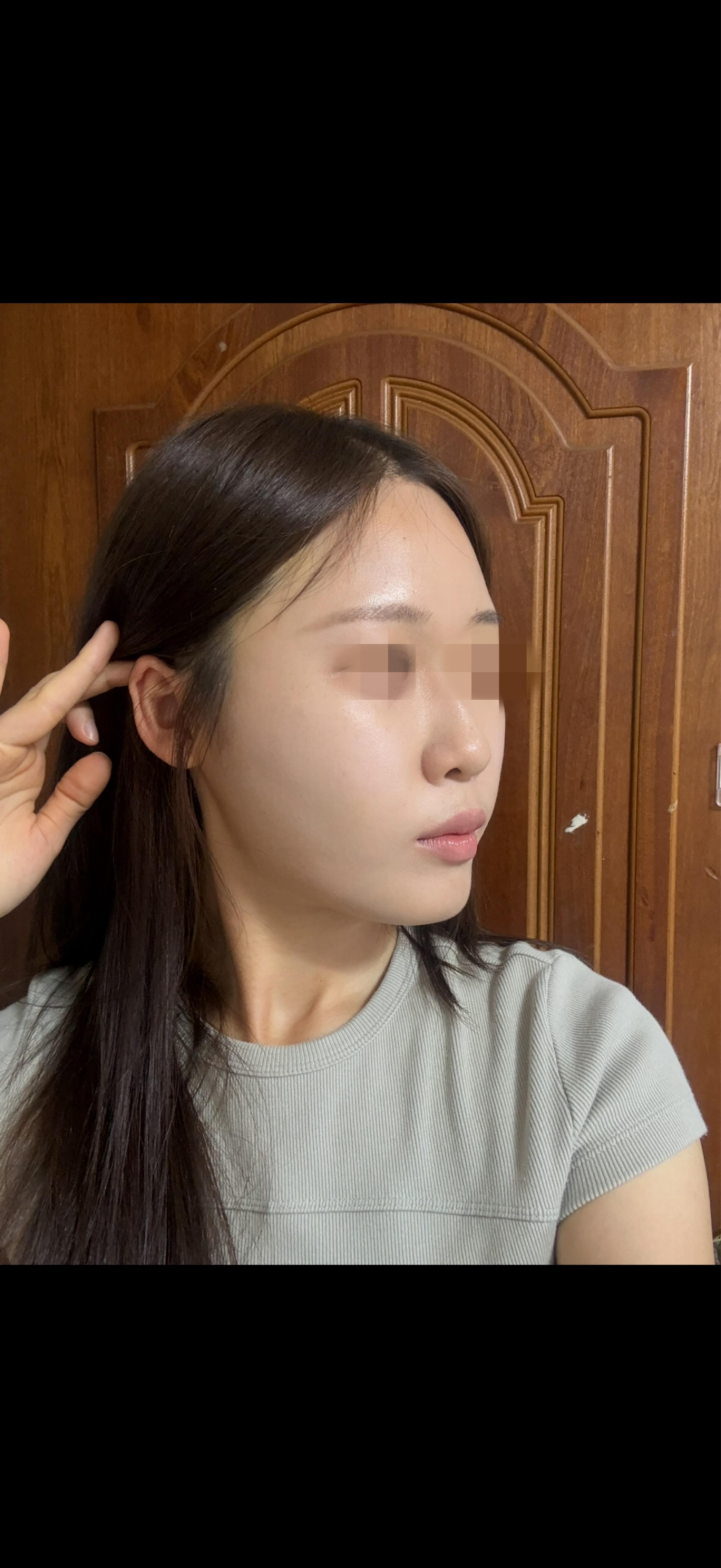 後
