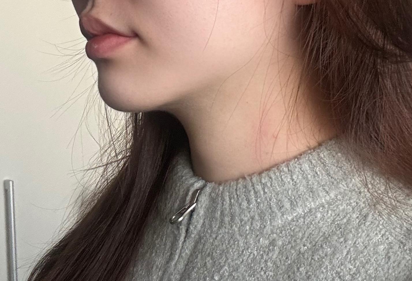 後