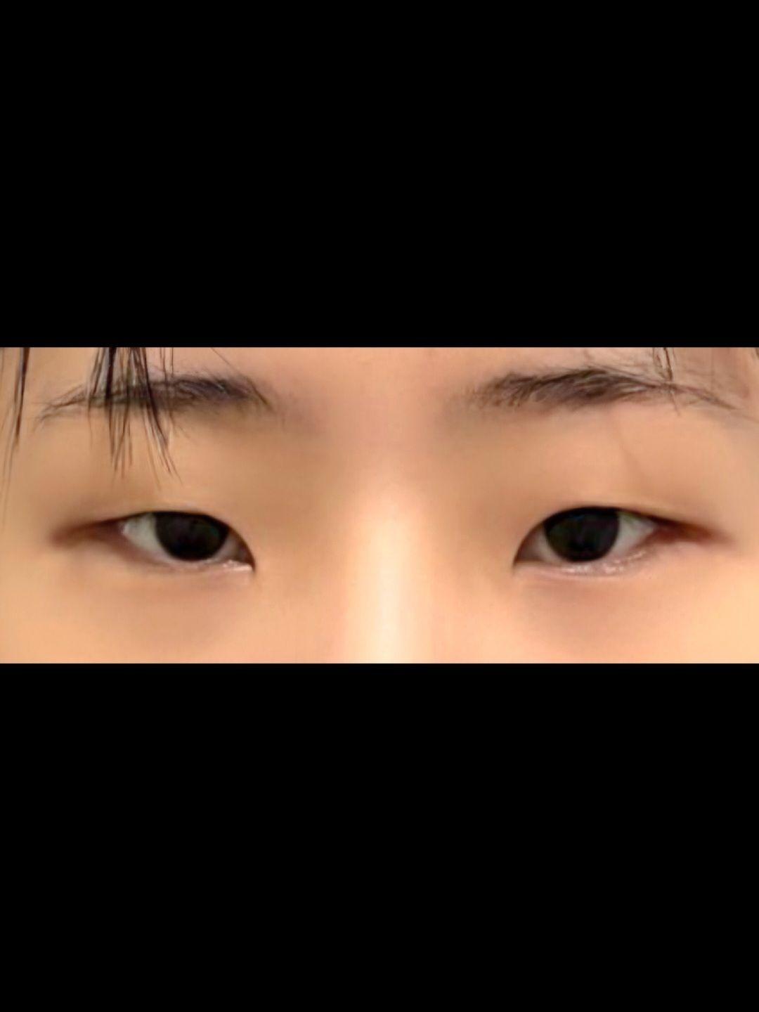 後