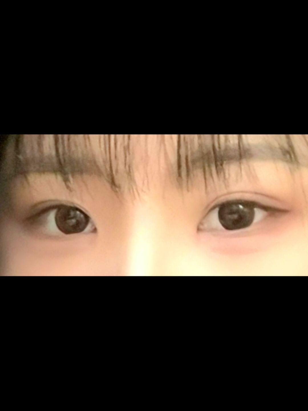 後