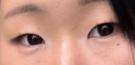 後
