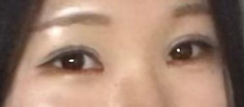 後