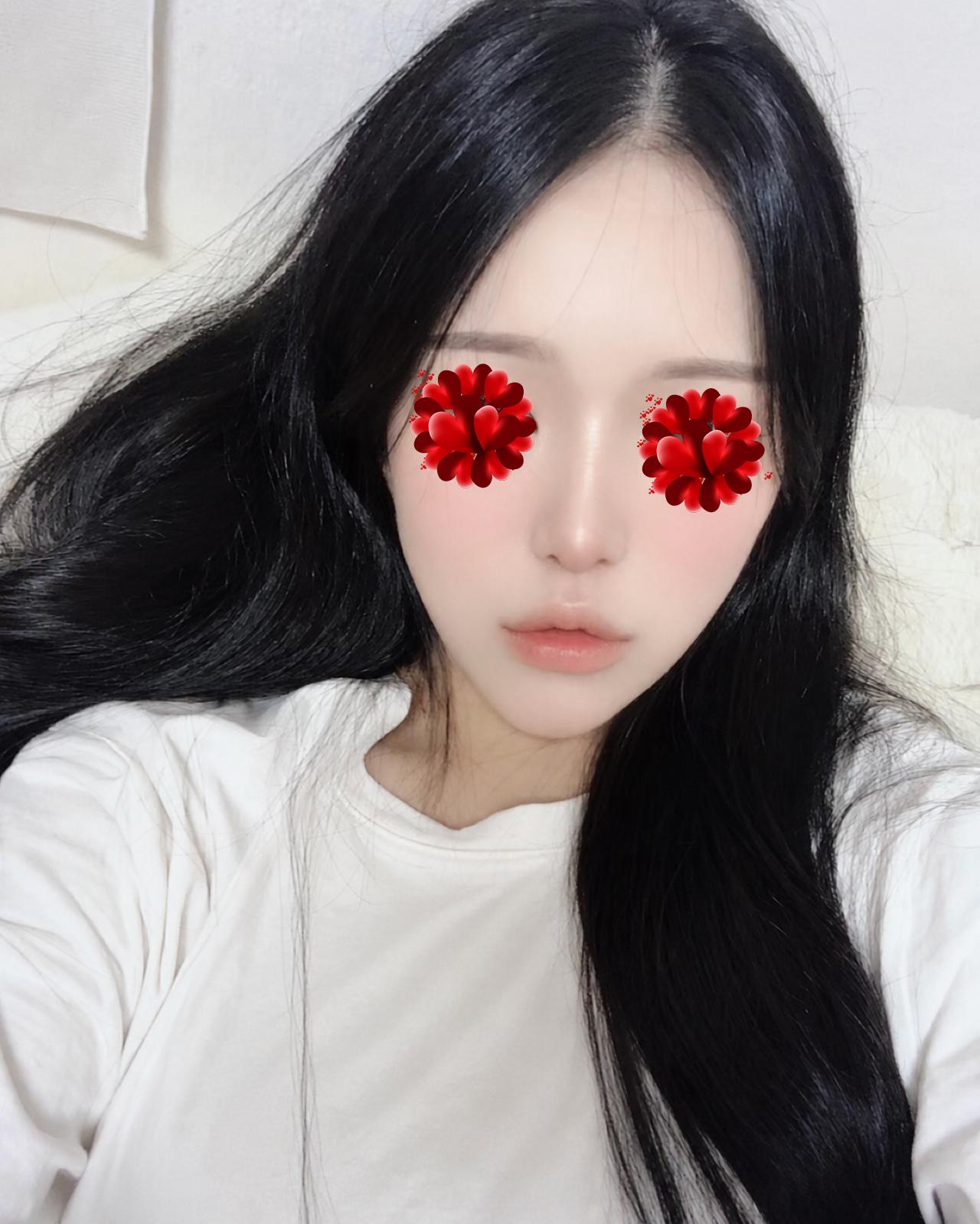 後