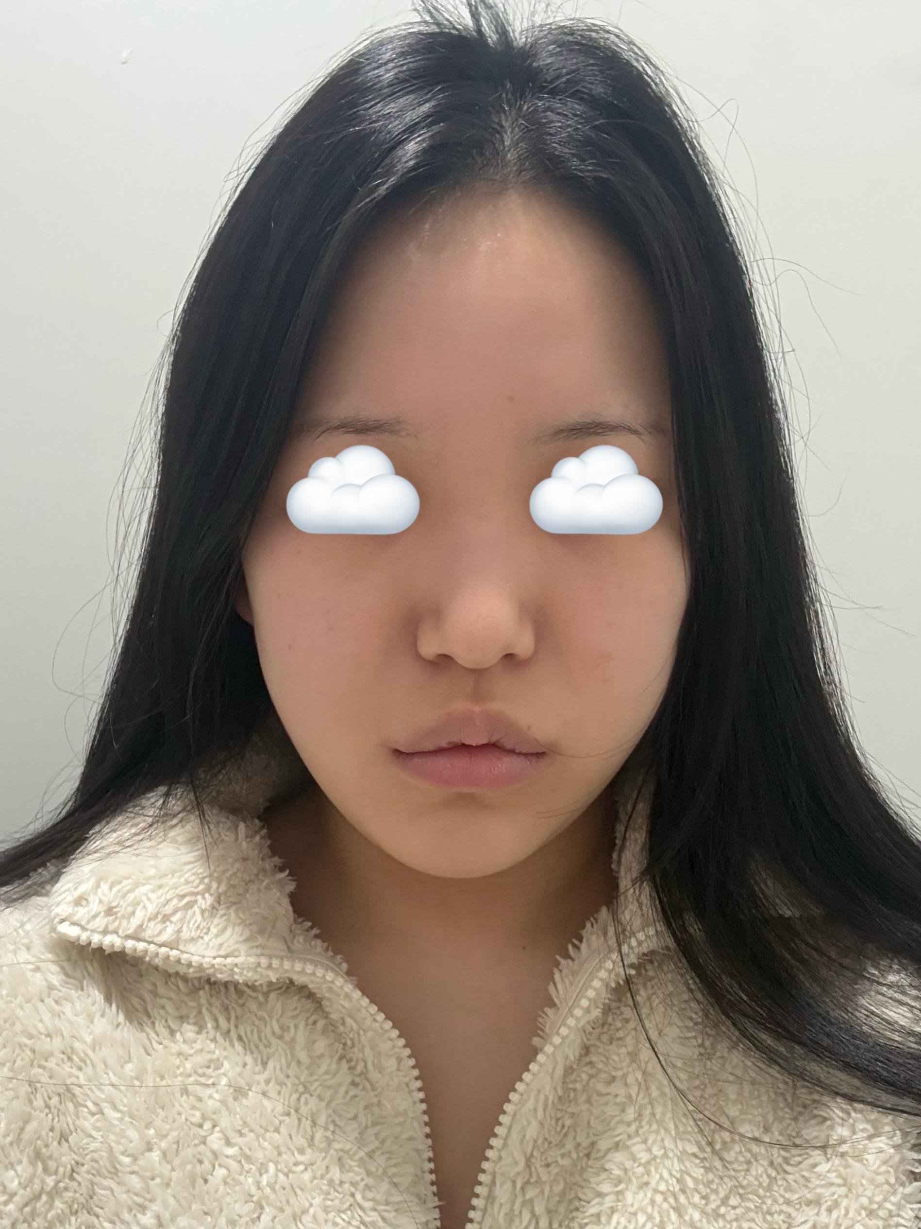 後
