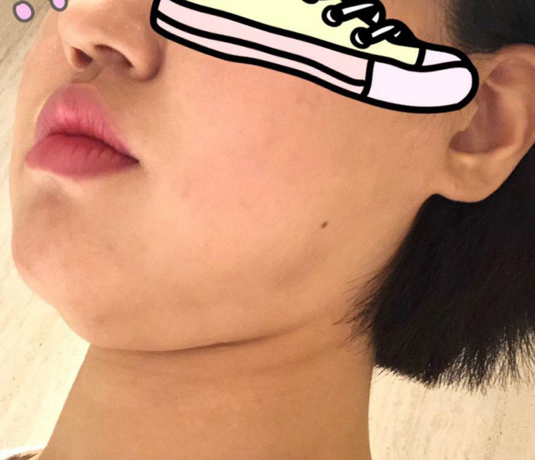 後