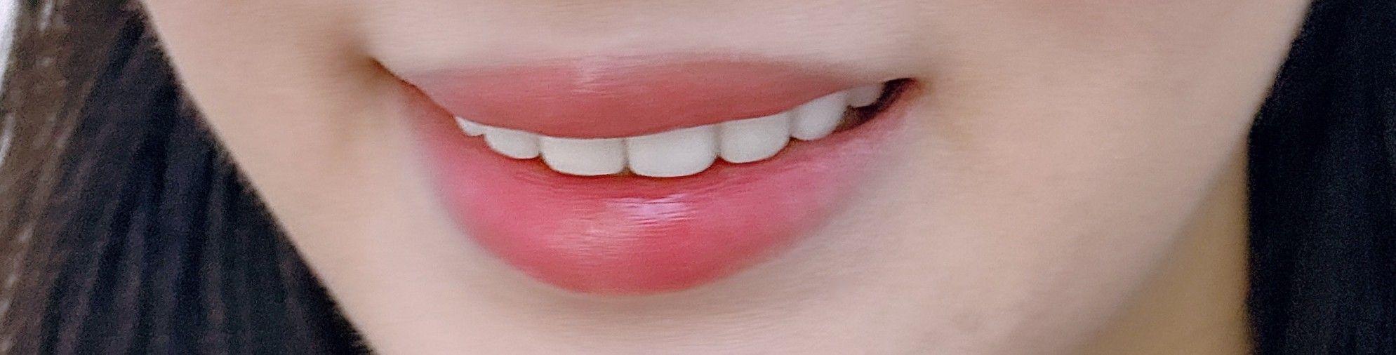 後