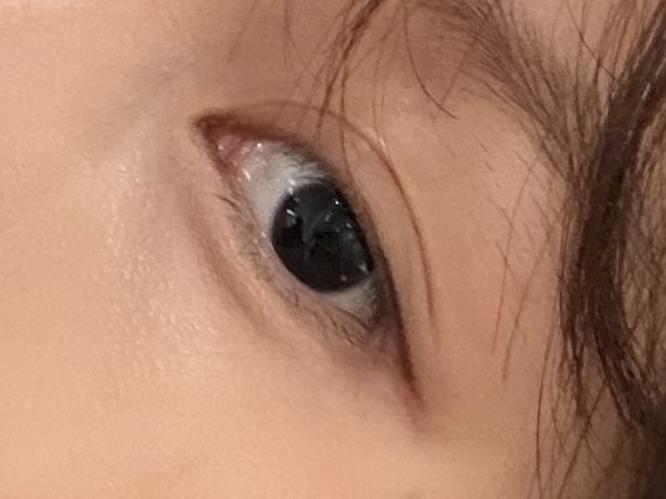 後