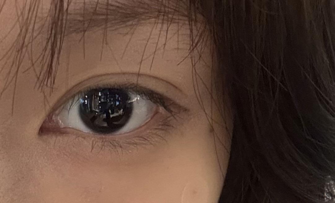 後