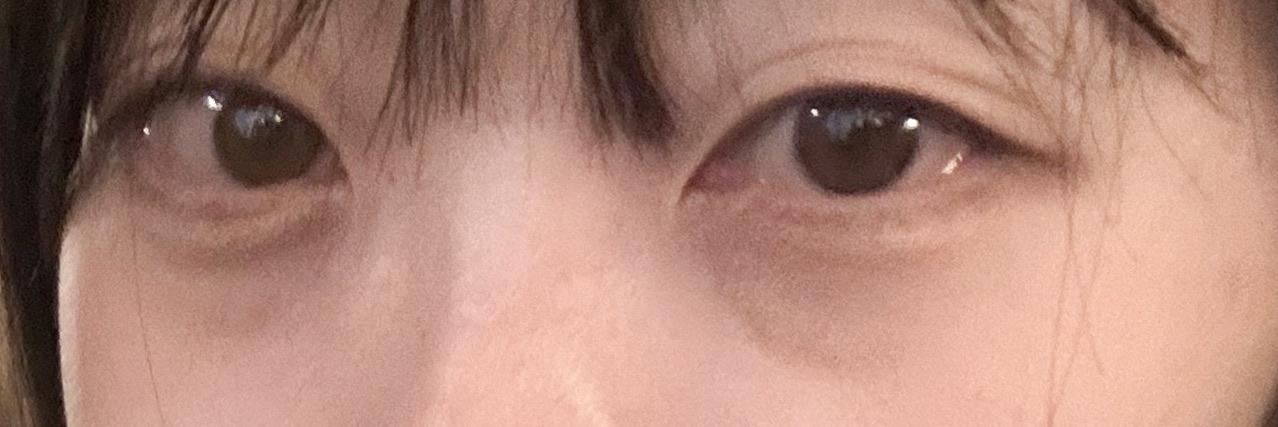 後