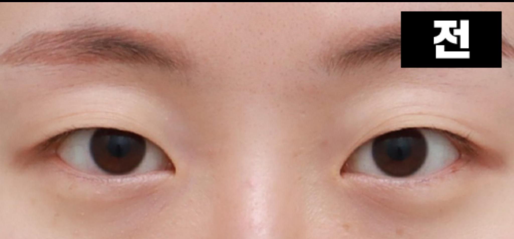 後