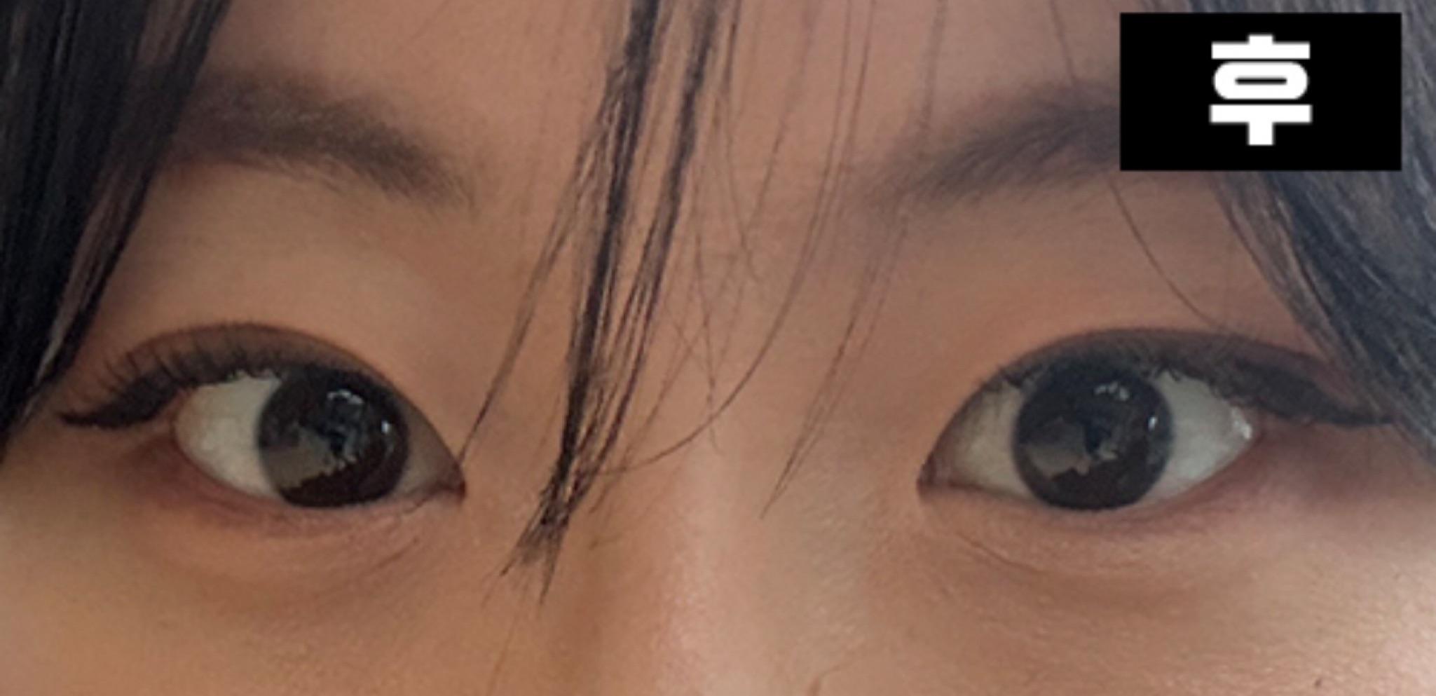 後