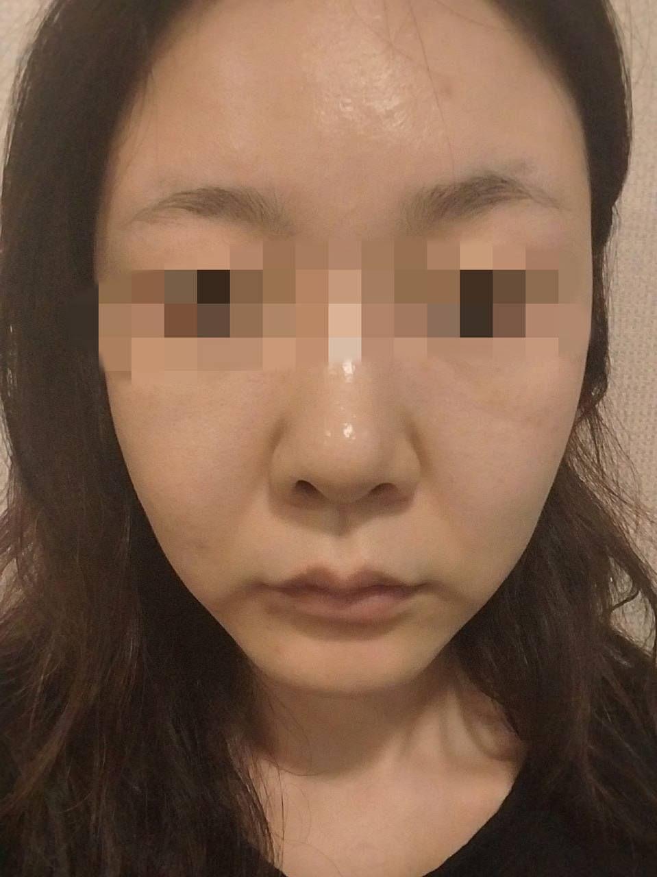 後