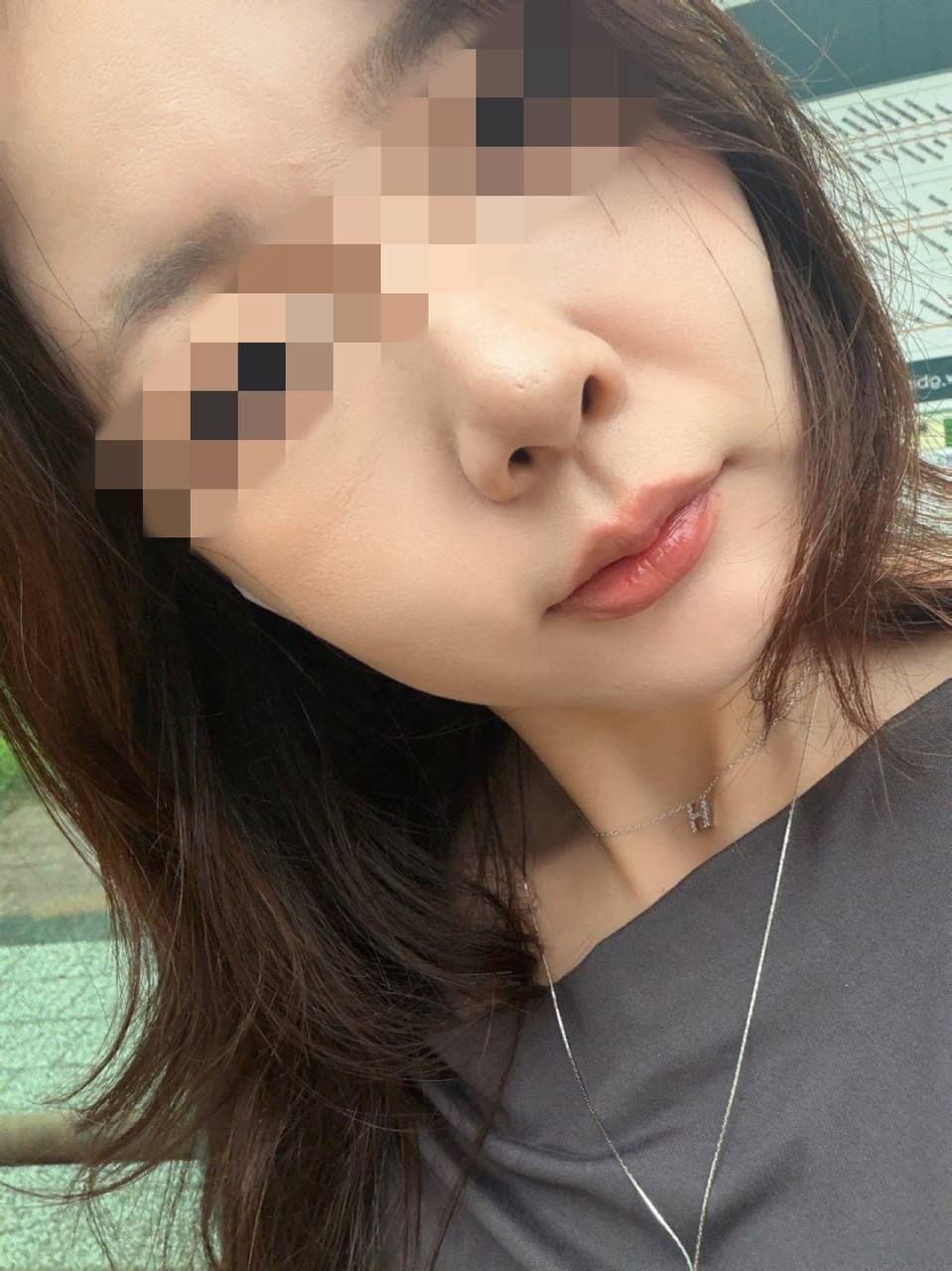 後