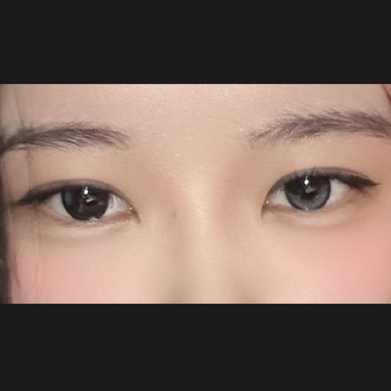 後
