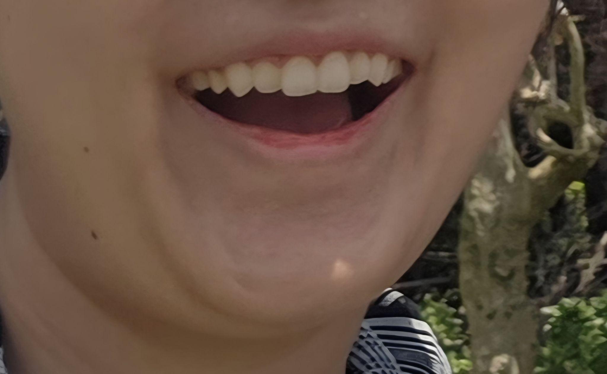 後