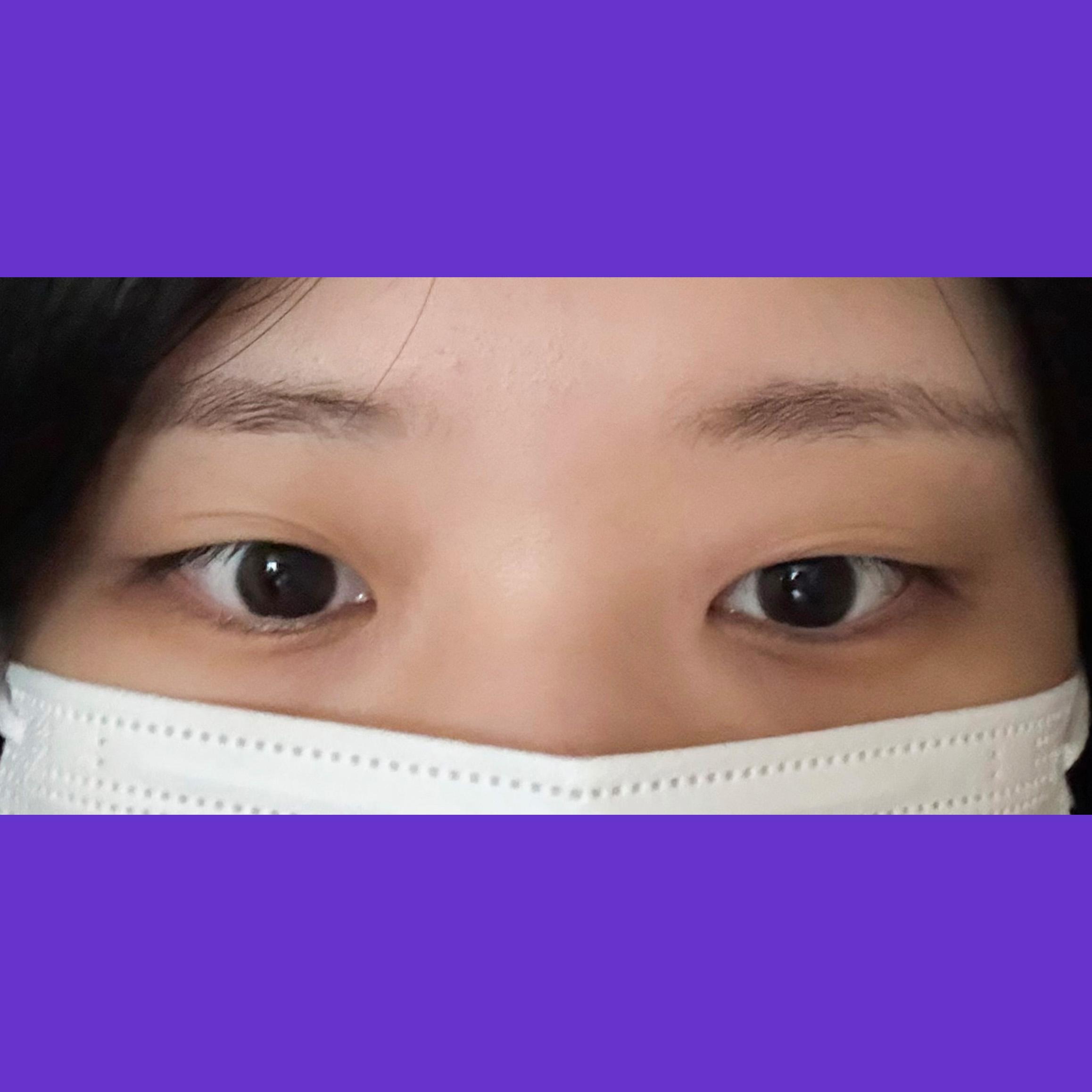 後