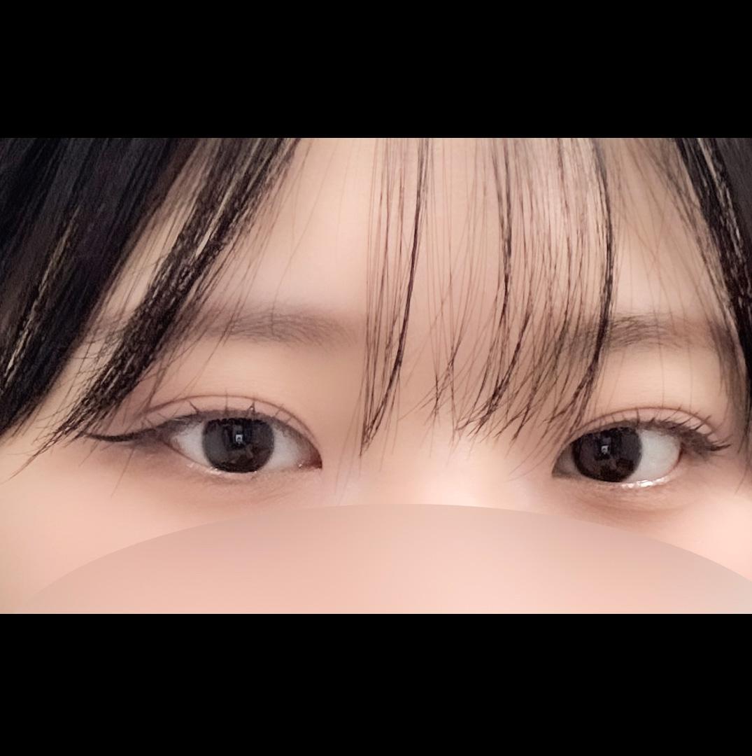後