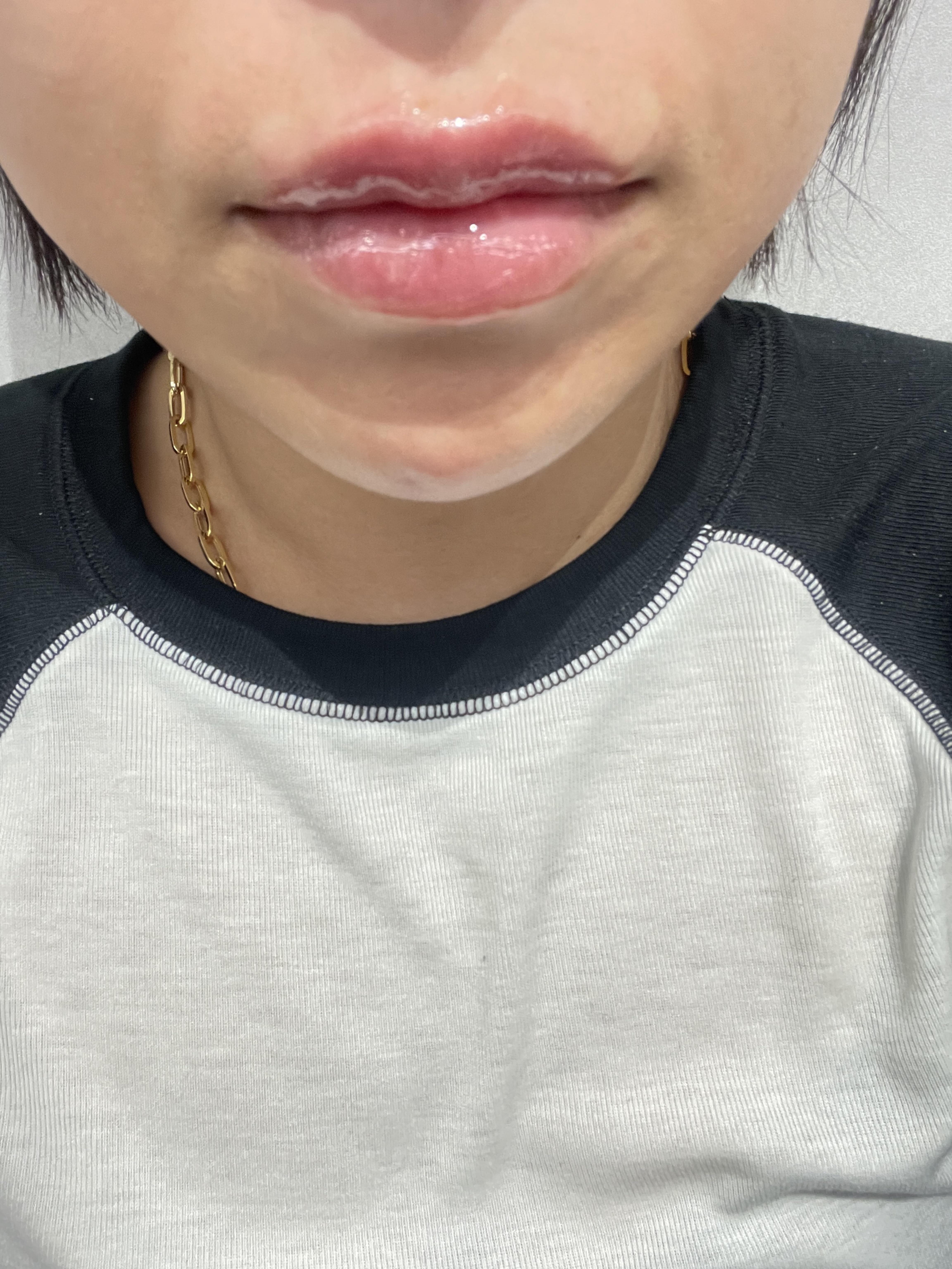 後