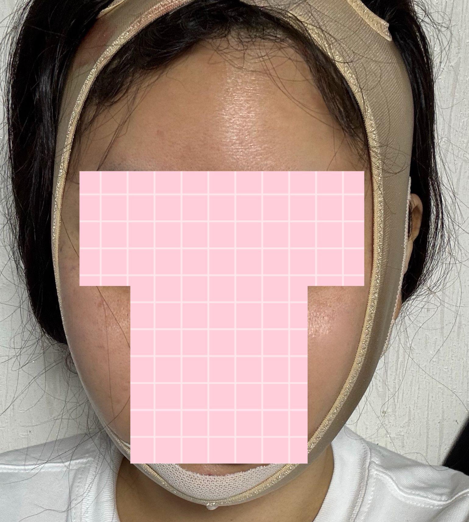 後