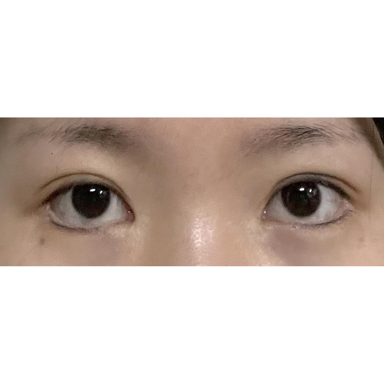 後