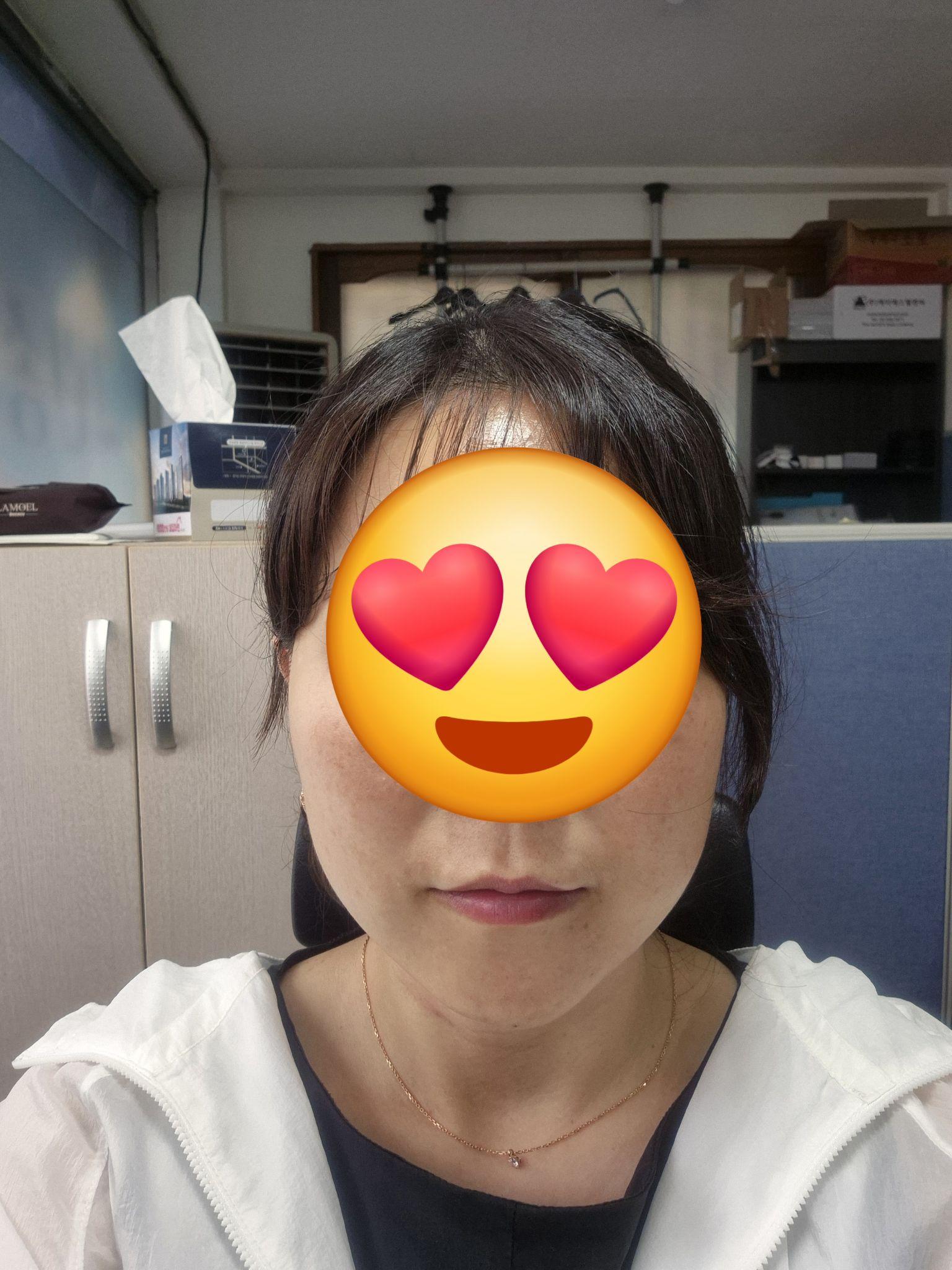 後